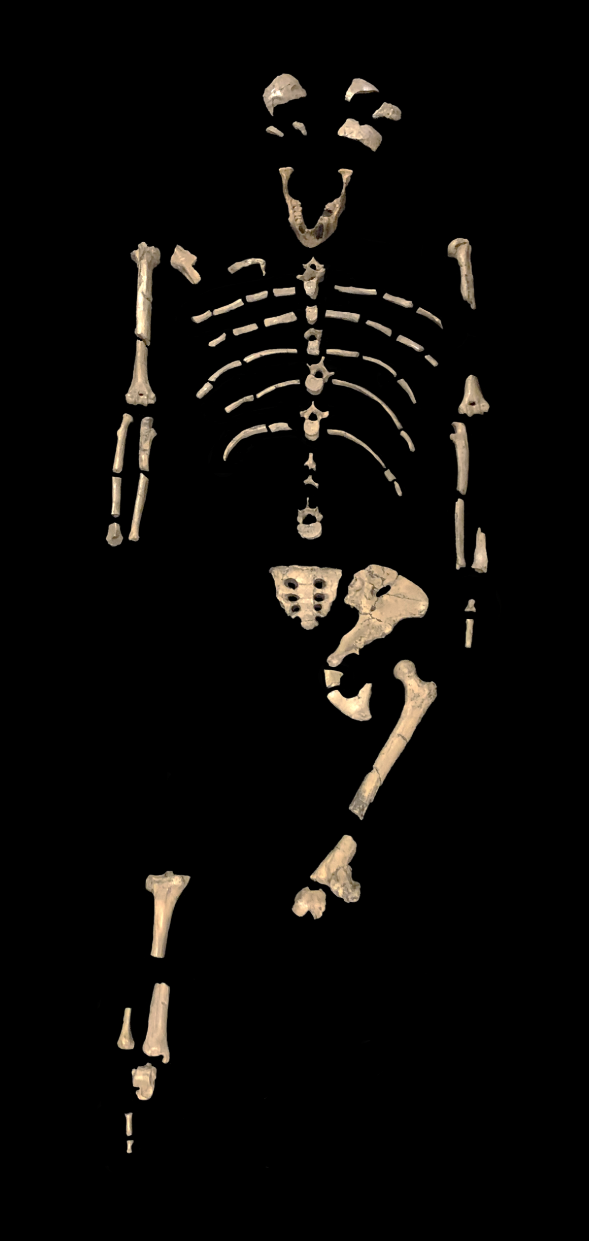 The TRUE Story of Lucy's Knee • New Creation Blog